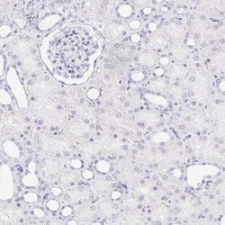 CXorf67 Antibody, Novus Biologicals 25 &mu;L; Unlabeled:Antibodies, Polyclonal